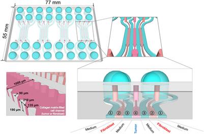 Tumor-on-a-chip: Perfusable vascular incorporation brings new approach to tumor metastasis research and drug development